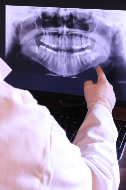 Best Emergency Root Canal Treatment in Malad City, ID